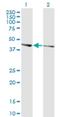 Phosphatase And Actin Regulator 3 antibody, H00116154-M02, Novus Biologicals, Western Blot image 