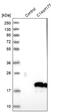 Chromosome 14 Open Reading Frame 177 antibody, PA5-53720, Invitrogen Antibodies, Western Blot image 