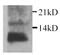 Interleukin 15 antibody, GTX27215, GeneTex, Western Blot image 