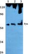 FYN Proto-Oncogene, Src Family Tyrosine Kinase antibody, A00684T524, Boster Biological Technology, Western Blot image 