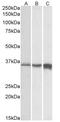 Troponin T3, Fast Skeletal Type antibody, AP32711PU-N, Origene, Western Blot image 