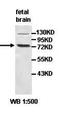 Acyl-CoA Synthetase Short Chain Family Member 1 antibody, orb77639, Biorbyt, Western Blot image 