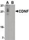 Cerebral Dopamine Neurotrophic Factor antibody, PA5-20430, Invitrogen Antibodies, Western Blot image 