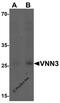 Vanin 3 antibody, 7057, ProSci, Western Blot image 