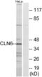 CLN6 Transmembrane ER Protein antibody, abx014348, Abbexa, Western Blot image 