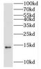 Hist2h2aa2 antibody, FNab03879, FineTest, Western Blot image 