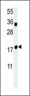 Trafficking Protein Particle Complex 6A antibody, LS-C160134, Lifespan Biosciences, Western Blot image 
