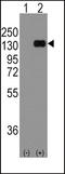 Cadherin 1 antibody, LS-C98224, Lifespan Biosciences, Western Blot image 