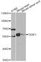 Telomeric Repeat Binding Factor 1 antibody, STJ27246, St John