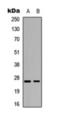 Rho GDP Dissociation Inhibitor Alpha antibody, orb393210, Biorbyt, Western Blot image 