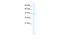 Potassium Channel Tetramerization Domain Containing 18 antibody, A17805, Boster Biological Technology, Western Blot image 