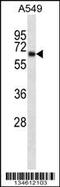 Potassium Voltage-Gated Channel Subfamily A Member 3 antibody, 57-918, ProSci, Western Blot image 