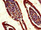 Regenerating Family Member 1 Alpha antibody, LS-C397018, Lifespan Biosciences, Immunohistochemistry paraffin image 