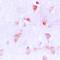 OCRL Inositol Polyphosphate-5-Phosphatase antibody, orb214344, Biorbyt, Immunohistochemistry paraffin image 