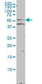 Nuclear Receptor Subfamily 1 Group H Member 2 antibody, LS-C198412, Lifespan Biosciences, Western Blot image 