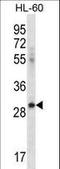 Inducible T Cell Costimulator Ligand antibody, LS-C165109, Lifespan Biosciences, Western Blot image 