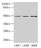Pregnancy Specific Beta-1-Glycoprotein 6 antibody, LS-C397158, Lifespan Biosciences, Western Blot image 