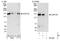 Valosin Containing Protein Interacting Protein 1 antibody, NBP1-49939, Novus Biologicals, Western Blot image 