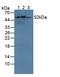 Cytochrome P450 Family 21 Subfamily A Member 2 antibody, LS-C723961, Lifespan Biosciences, Western Blot image 