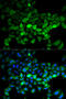 Ubiquitin Conjugating Enzyme E2 C antibody, 19-701, ProSci, Immunofluorescence image 