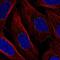 Dpy-19 Like C-Mannosyltransferase 1 antibody, NBP2-31748, Novus Biologicals, Immunocytochemistry image 