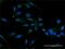 Cyclin D2 antibody, H00000894-D01P, Novus Biologicals, Immunocytochemistry image 