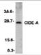 Cell Death Inducing DFFA Like Effector A antibody, 2089, ProSci Inc, Western Blot image 