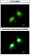 Aminoacyl TRNA Synthetase Complex Interacting Multifunctional Protein 2 antibody, GTX118947, GeneTex, Immunofluorescence image 