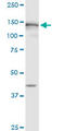 MutS Homolog 6 antibody, LS-C197374, Lifespan Biosciences, Western Blot image 
