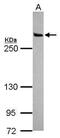 Leucine Rich Repeat Kinase 2 antibody, GTX113067, GeneTex, Western Blot image 