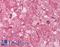 Misshapen Like Kinase 1 antibody, LS-A7408, Lifespan Biosciences, Immunohistochemistry paraffin image 