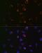 Voltage Dependent Anion Channel 1 antibody, GTX01543, GeneTex, Immunocytochemistry image 