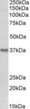 Syndecan 1 antibody, MBS423223, MyBioSource, Western Blot image 