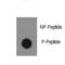 ABL Proto-Oncogene 1, Non-Receptor Tyrosine Kinase antibody, LS-C97399, Lifespan Biosciences, Dot Blot image 