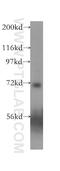 Amiloride-sensitive cation channel 4 antibody, 12003-1-AP, Proteintech Group, Western Blot image 