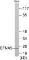 Ephrin A5 antibody, EKC1747, Boster Biological Technology, Western Blot image 