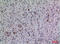 Fibroblast Growth Factor 5 antibody, STJ96555, St John