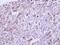 CDMP1 antibody, GTX108415, GeneTex, Immunohistochemistry paraffin image 