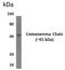 Interleukin 2 Receptor Subunit Gamma antibody, GTX53453, GeneTex, Western Blot image 