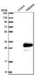 Transmembrane Protein 98 antibody, NBP1-84154, Novus Biologicals, Western Blot image 