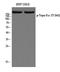 DNA Topoisomerase II Alpha antibody, A00953T1343, Boster Biological Technology, Western Blot image 
