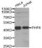 PHD Finger Protein 6 antibody, abx004613, Abbexa, Western Blot image 