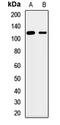 Solute Carrier Family 12 Member 7 antibody, LS-C668584, Lifespan Biosciences, Western Blot image 