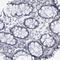 Synuclein Gamma antibody, HPA014404, Atlas Antibodies, Immunohistochemistry paraffin image 