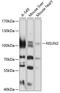 NOP2/Sun RNA Methyltransferase 2 antibody, 19-069, ProSci, Western Blot image 
