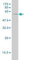 Phosphoglycerate Dehydrogenase antibody, H00026227-M01, Novus Biologicals, Western Blot image 