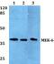Mitogen-Activated Protein Kinase Kinase 6 antibody, PA5-36170, Invitrogen Antibodies, Western Blot image 
