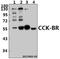 Cholecystokinin B Receptor antibody, GTX66711, GeneTex, Western Blot image 
