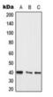 Mitogen-Activated Protein Kinase Kinase 3 antibody, orb223989, Biorbyt, Western Blot image 