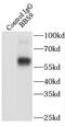Bardet-Biedl Syndrome 9 antibody, FNab00825, FineTest, Immunoprecipitation image 